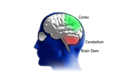 Cortex, cerebellum, and brain stem